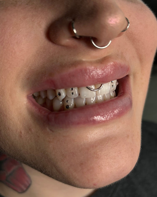 Tooth gem application